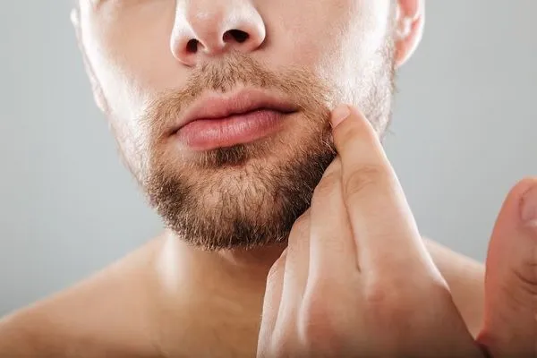 Injerto de barba, ¿por qué se lleva a cabo? 2 Injerto de barba, ¿por qué se lleva a cabo?