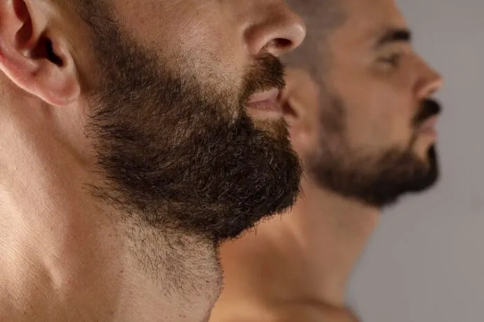Que faut-il savoir sur les greffes de barbe ?