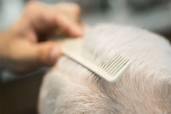 La poliose ou mèche blanche dans les cheveux