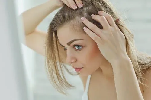 Las razones por las que se les cae el pelo a las mujeres jóvenes