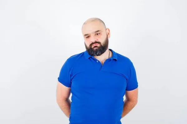 Caída del cabello y obesidad, ¿cómo se relacionan? 2 Caída del cabello y obesidad, ¿cómo se relacionan?
