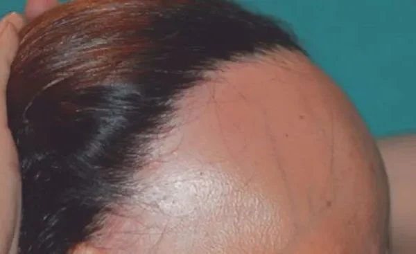 Cheveux à faible volume: comment les augmenter