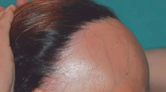 Cheveux à faible volume: comment les augmenter