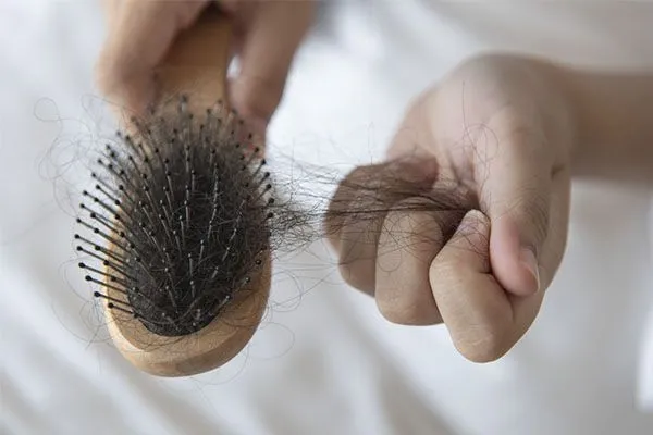Le syndrome des ovaires polykystiques et la perte de cheveux sont-ils liés ?