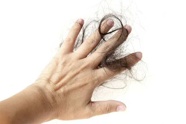 Le syndrome des ovaires polykystiques et la perte de cheveux sont-ils liés ?