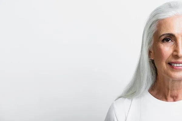 La poliose ou mèche blanche dans les cheveux 2 La poliose ou mèche blanche dans les cheveux