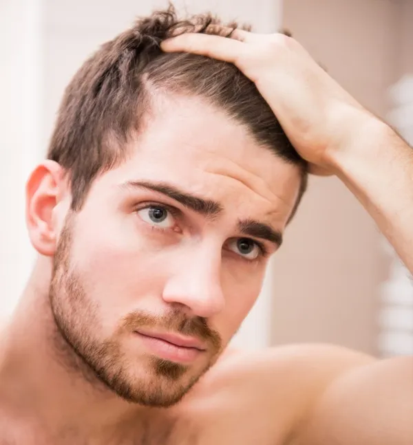 Cómo prevenir la caída del cabello 2 Cómo prevenir la caída del cabello