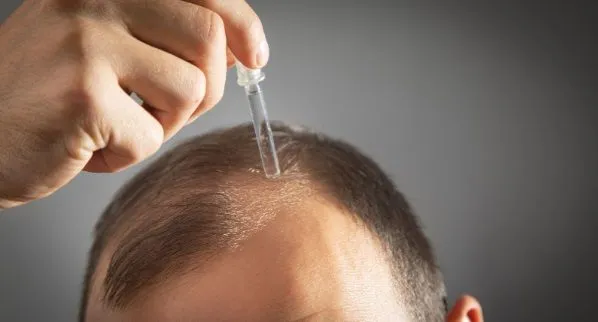 Claves para cuidar el cabello trasplantado