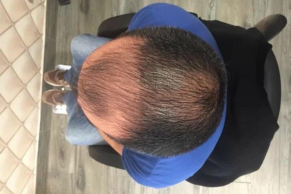 ¿Qué es un regenerador capilar y dónde encontrarlo?
