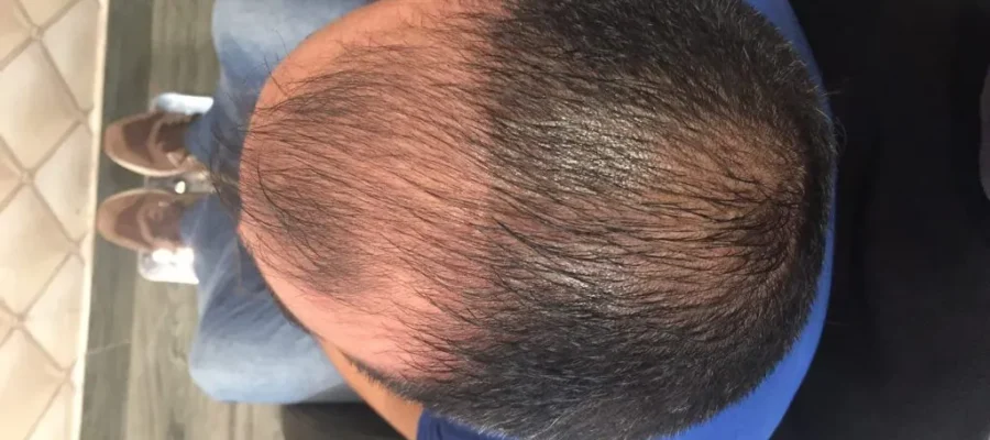 Qu’est-ce qu’un régénérateur de cheveux et où le trouver ? 1 Qu’est-ce qu’un régénérateur de cheveux et où le trouver ?