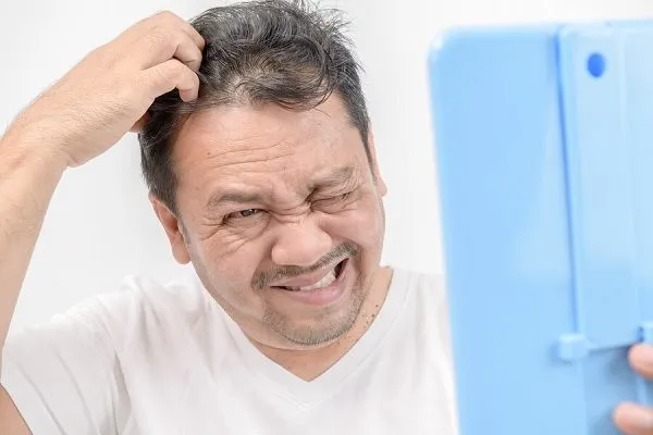 ¿Se puede reparar un injerto capilar? 2 ¿Se puede reparar un injerto capilar?