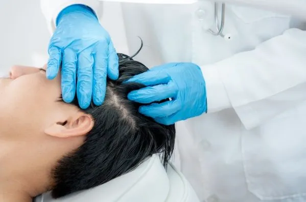 ¿A qué edad es prudente revisar el cabello?