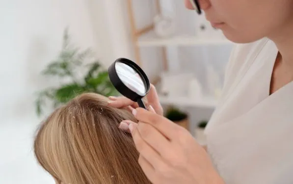 Cómo prevenir la caída del cabello 8 Cómo prevenir la caída del cabello