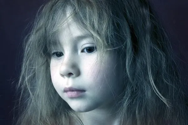 Síndrome del cabello impeinable