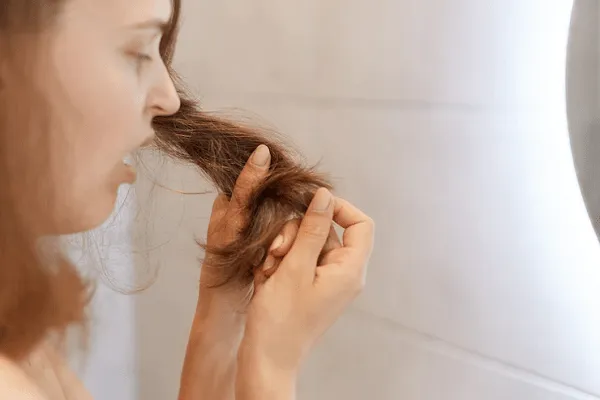 ¿El síndrome de ovario poliquístico y la caída del cabello tienen relación?