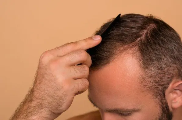 El trasplante de pelo influye en la felicidad