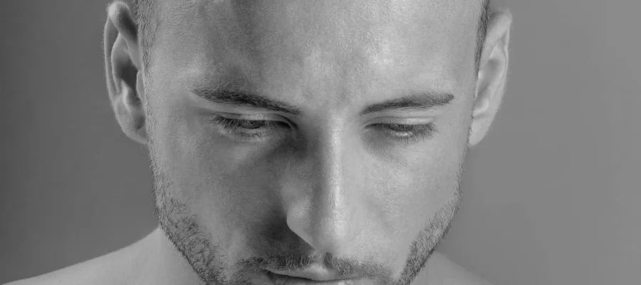 El perfil de las personas que acuden a Turquía en busca del pelo perdido