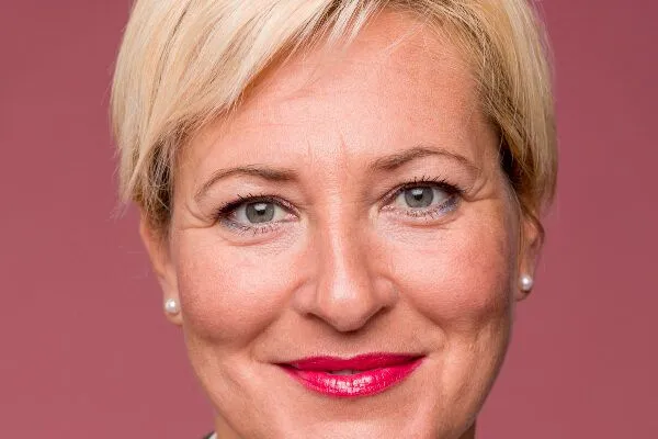 Acconciature per donne con alopecia frontale 2 Acconciature per donne con alopecia frontale