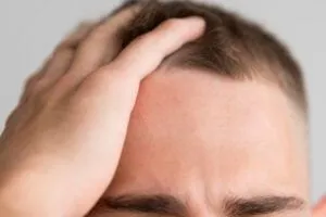 Cos’è la tricopigmentazione capillare? 2 Cos’è la tricopigmentazione capillare?