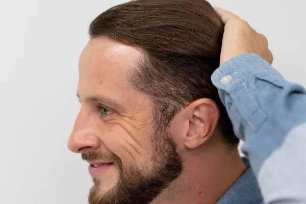 Come evitare la caduta dei capelli, cosa prendere? Può essere evitata?