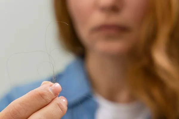 Perché mi prude la testa e mi cadono i capelli?