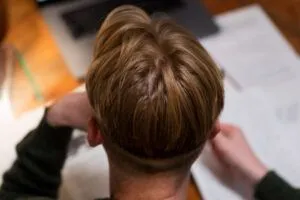 Costo trapianto capelli Turchia 2026: prezzi e migliori cliniche 3 Costo trapianto capelli Turchia 2026: prezzi e migliori cliniche