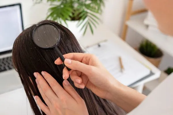 Quali sono i benefici dell’olio di argan per i capelli? 3 Quali sono i benefici dell’olio di argan per i capelli?