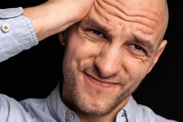Calvo a meno di 30 anni: cosa posso fare?