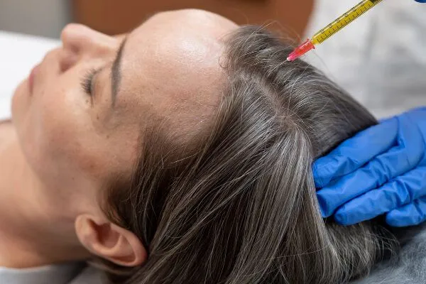 Calvo a meno di 30 anni: cosa posso fare?