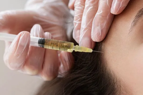 Caduta dei capelli correlata allo stress