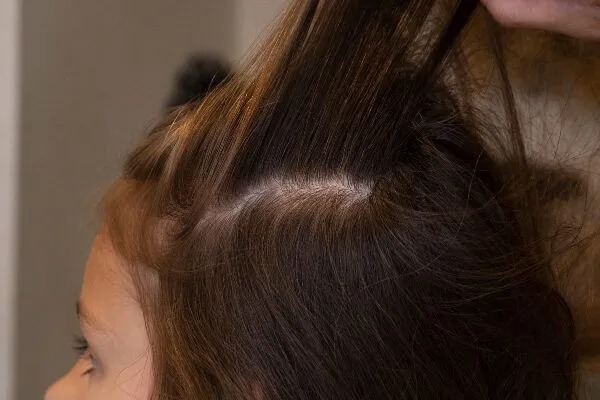 Il miglior trattamento per l’idratazione dei capelli 3 Il miglior trattamento per l’idratazione dei capelli