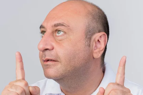 Perché sempre più Spagnoli si fanno impiantare i capelli