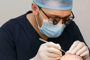 La migliore clinica trapianto capelli Turchia: Come sceglierla?