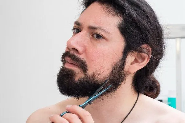 Cos’è l’ipertricosi?