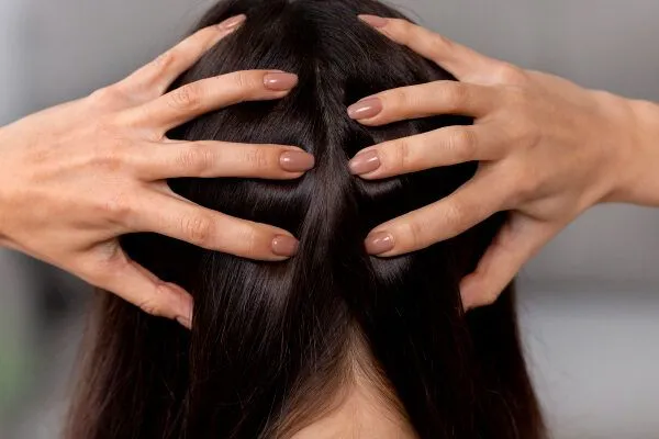 Alopecia seborroica: cause, sintomi e rimedi efficaci 6 Alopecia seborroica: cause, sintomi e rimedi efficaci