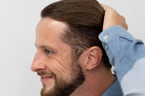 Le fasi di crescita dei capelli 2 Le fasi di crescita dei capelli