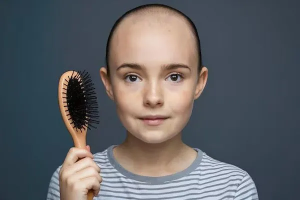 Alopecia nei bambini, è possibile?