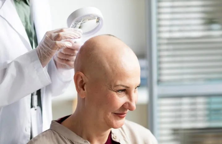 Greffe de cheveux : comment évaluer l’avis des médecins ?