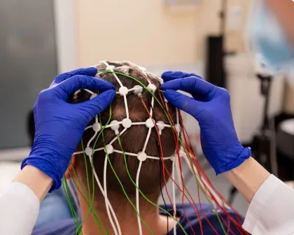 L’intelligence Artificielle révolutionne-t-elle vraiment la greffe de cheveux ?