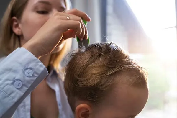 Alopecia nei bambini, è possibile?