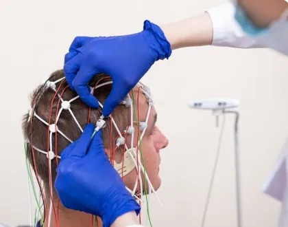 L’intelligence Artificielle révolutionne-t-elle vraiment la greffe de cheveux ?