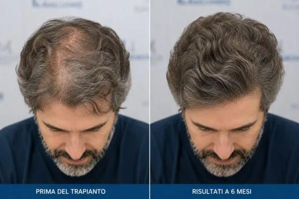 Quanto tempo ci vuole per vedere il risultato finale dellinnesto? 4 Quanto tempo ci vuole per vedere il risultato finale dellinnesto?