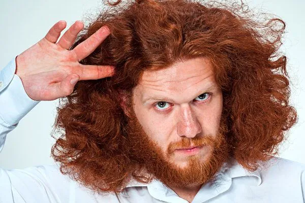 Sindrome dei capelli impettinabili 2 Sindrome dei capelli impettinabili