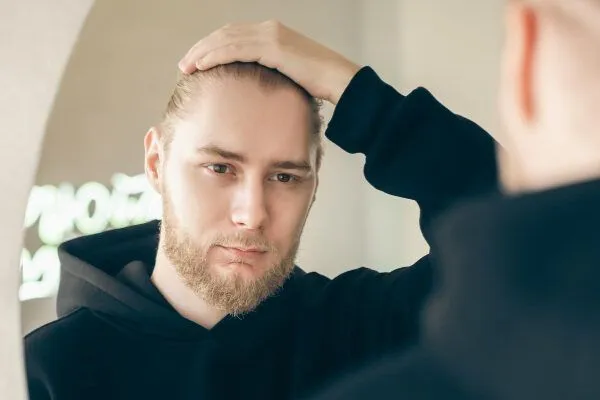 Sindrome dei capelli impettinabili 3 Sindrome dei capelli impettinabili