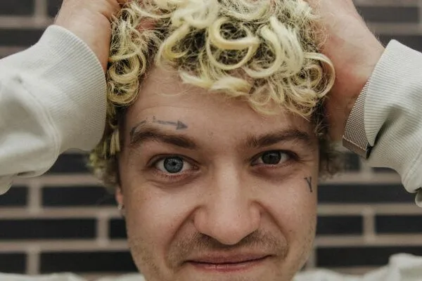 Sindrome dei capelli impettinabili 4 Sindrome dei capelli impettinabili