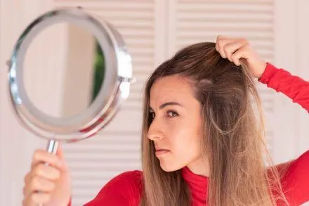 Spironolattone per l’alopecia femminile