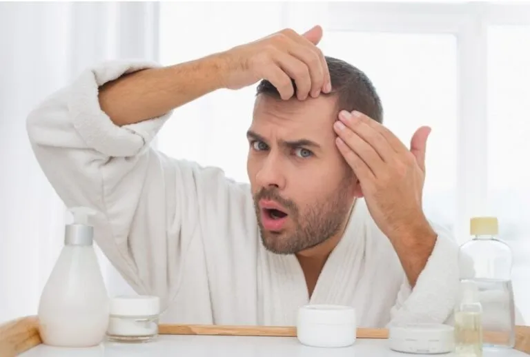 Troubles du cuir chevelu à traiter : Symptômes et solutions 5 Troubles du cuir chevelu à traiter : Symptômes et solutions