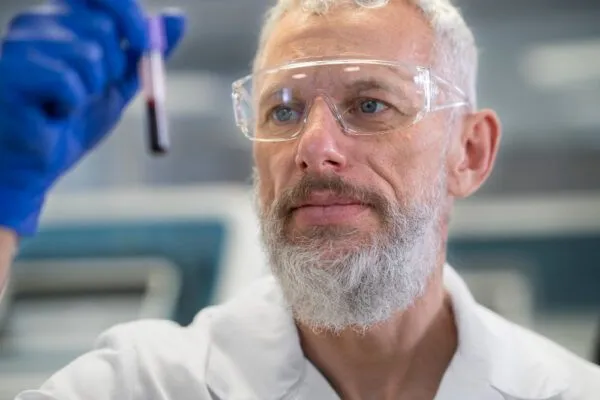 Trapianto di barba: perché viene eseguito? 4 Trapianto di barba: perché viene eseguito?