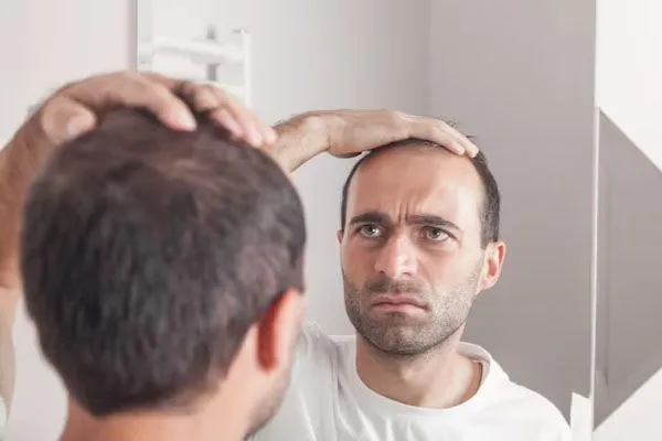 Immunosoppressori per l’Alopecia Areata: Quando e Perché Vengono Utilizzati 6 Immunosoppressori per l’Alopecia Areata: Quando e Perché Vengono Utilizzati