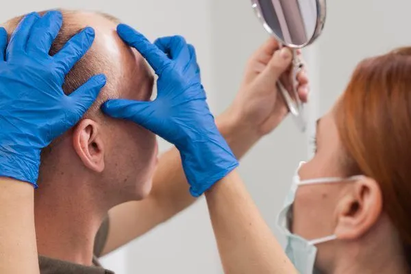 Trattamenti per l’Alopecia Areata: Cure Mediche e Terapie Disponibili 5 Trattamenti per l’Alopecia Areata: Cure Mediche e Terapie Disponibili